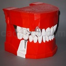 牙科演示模型3D打印模型STL格式