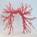 3D打印模型肺动脉切片